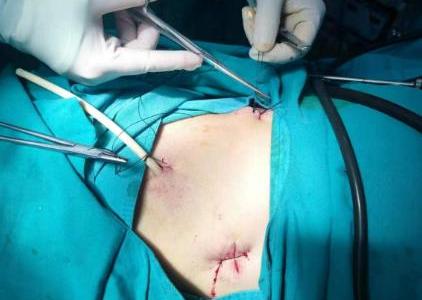 C:\Users\ADMINI~1\AppData\Local\Temp\WeChat Files\7c74a977dba796a696c2df999559c06.jpg